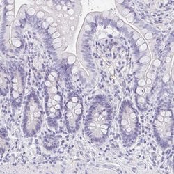 Invitrogen EQTN Polyclonal Antibody 100 &mu;L; Unconjugated:Antibodies,
