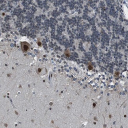 Invitrogen SRPK2 Polyclonal Antibody 100 &mu;L; Unconjugated:Antibodies,