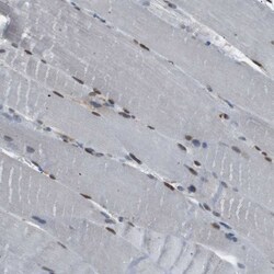 Invitrogen SRPK2 Polyclonal Antibody 100 &mu;L; Unconjugated:Antibodies,