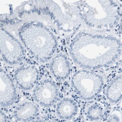 Invitrogen SRPK2 Polyclonal Antibody 100 &mu;L; Unconjugated:Antibodies,