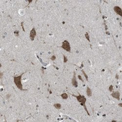 Invitrogen SRPK2 Polyclonal Antibody 100 &mu;L; Unconjugated:Antibodies,