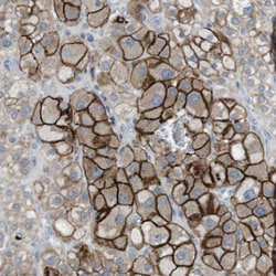Invitrogen TYW1 Polyclonal Antibody 100 &mu;L; Unconjugated:Antibodies,