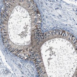 Invitrogen LRIG2 Polyclonal Antibody 100 &mu;L; Unconjugated:Antibodies,