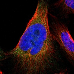JWA Polyclonal Antibody:Antibodies, Polyclonal