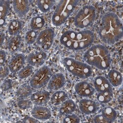JWA Polyclonal Antibody:Antibodies, Polyclonal