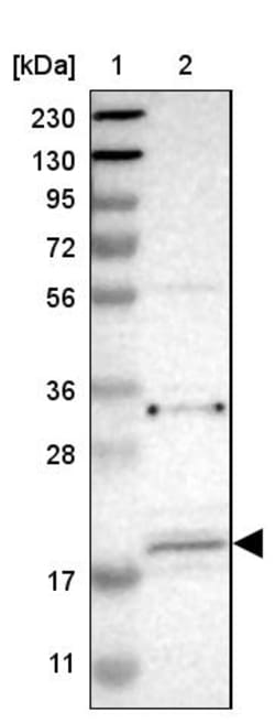 Invitrogen JWA Polyclonal Antibody 100 &mu;L; Unconjugated:Antibodies,