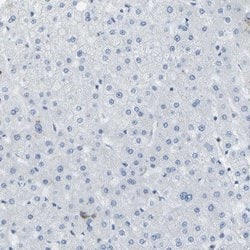 Invitrogen WNK2 Polyclonal Antibody 100 &mu;L; Unconjugated:Antibodies,