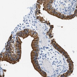 Invitrogen Unc18-2 Polyclonal Antibody 100 &mu;L | Buy Online | Invitrogen&trade; | Fisher Scientific