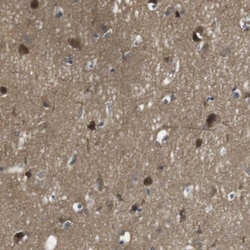Invitrogen LRP15 Polyclonal Antibody 100 &mu;L; Unconjugated:Antibodies,