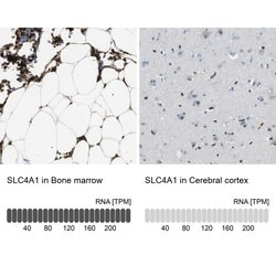 Invitrogen SLC4A1 Polyclonal Antibody 100 &mu;L; Unconjugated:Antibodies,