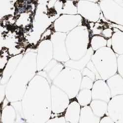Invitrogen SLC4A1 Polyclonal Antibody 100 &mu;L; Unconjugated:Antibodies,