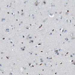 Invitrogen SLC4A1 Polyclonal Antibody 100 &mu;L; Unconjugated:Antibodies,