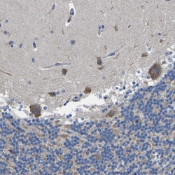 Invitrogen TMEFF2 Polyclonal Antibody 100 &mu;L | Buy Online | Invitrogen&trade; | Fisher Scientific