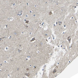 Invitrogen TMEFF2 Polyclonal Antibody 100 &mu;L | Buy Online | Invitrogen&trade; | Fisher Scientific