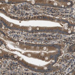 Invitrogen TBC1D15 Polyclonal Antibody 100 &mu;L; Unconjugated:Antibodies,