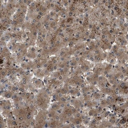 Invitrogen TBC1D15 Polyclonal Antibody 100 &mu;L; Unconjugated:Antibodies,