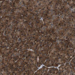 Invitrogen TBC1D15 Polyclonal Antibody 100 &mu;L; Unconjugated:Antibodies,