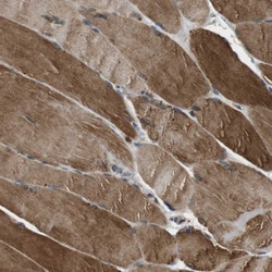 Invitrogen TBC1D15 Polyclonal Antibody 100 &mu;L; Unconjugated:Antibodies,