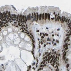 Invitrogen NSRP1 Polyclonal Antibody 100 &mu;L; Unconjugated:Antibodies,