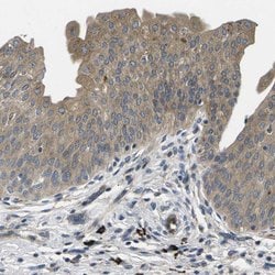 Invitrogen PLCE1 Polyclonal Antibody 100 &mu;L; Unconjugated:Antibodies,