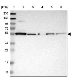 Invitrogen PEPD Polyclonal Antibody 100 &mu;L; Unconjugated:Antibodies,