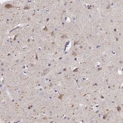 Invitrogen Kiaa0319 Polyclonal Antibody 100 &mu;L; Unconjugated:Antibodies,