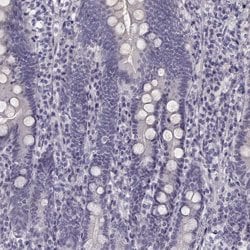 Invitrogen Kiaa0319 Polyclonal Antibody 100 &mu;L; Unconjugated:Antibodies,