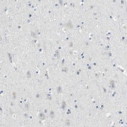 Invitrogen Granzyme M Polyclonal Antibody 100 &mu;L; Unconjugated:Antistoffer