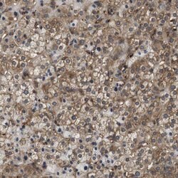 Invitrogen HERPUD2 Polyclonal Antibody 100 &mu;L; Unconjugated:Antibodies,