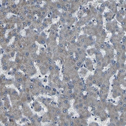 Invitrogen AFAP Polyclonal Antibody 100 &mu;L; Unconjugated:Antibodies,