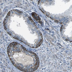 Invitrogen AFAP Polyclonal Antibody 100 &mu;L; Unconjugated:Antibodies,