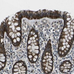 Invitrogen AFAP Polyclonal Antibody 100 &mu;L; Unconjugated:Antibodies,