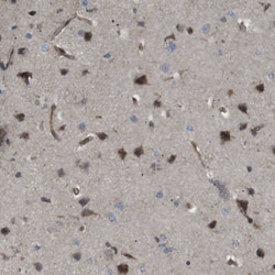 Invitrogen KANK2 Polyclonal Antibody 100 &mu;L; Unconjugated:Antibodies,