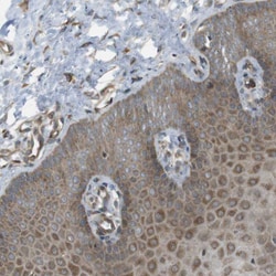 Invitrogen KANK2 Polyclonal Antibody 100 &mu;L; Unconjugated:Antibodies,