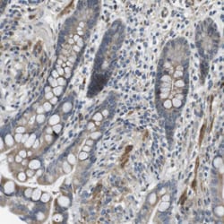 Invitrogen KANK2 Polyclonal Antibody 100 &mu;L; Unconjugated:Antibodies,