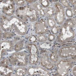 Invitrogen KANK2 Polyclonal Antibody 100 &mu;L; Unconjugated:Antibodies,