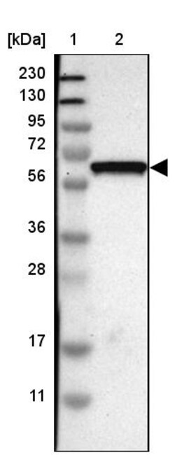 Invitrogen GDF5 Polyclonal Antibody 100 &mu;L | Buy Online | Invitrogen&trade; | Fisher Scientific