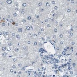 Invitrogen RTN3 Polyclonal Antibody 100 &mu;L; Unconjugated:Anticuerpos