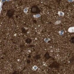 Invitrogen RTN3 Polyclonal Antibody 100 &mu;L; Unconjugated:Anticuerpos