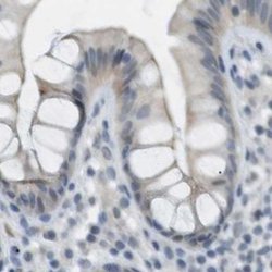 Invitrogen RTN3 Polyclonal Antibody 100 &mu;L; Unconjugated:Anticuerpos