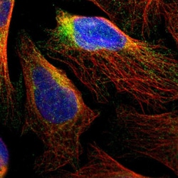 Invitrogen RTN3 Polyclonal Antibody 100 &mu;L; Unconjugated:Antibodies,