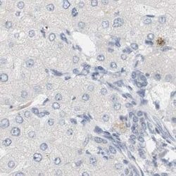 Invitrogen RTN3 Polyclonal Antibody 100 &mu;L; Unconjugated:Antibodies,