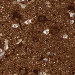 Invitrogen RTN3 Polyclonal Antibody 100 &mu;L; Unconjugated:Antibodies,