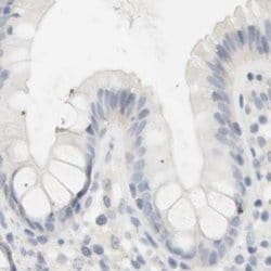 Invitrogen RTN3 Polyclonal Antibody 100 &mu;L; Unconjugated:Antibodies,