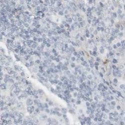 Invitrogen RTN3 Polyclonal Antibody 100 &mu;L; Unconjugated:Antibodies,