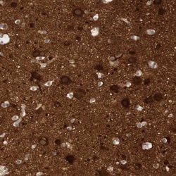 Invitrogen RTN3 Polyclonal Antibody 100 &mu;L; Unconjugated:Antibodies,
