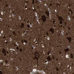 DCLK1 Polyclonal Antibody:Antibodies, Polyclonal