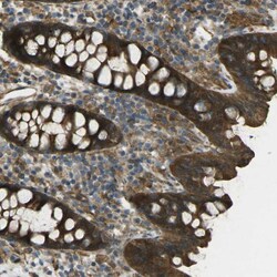 Invitrogen CHMP3 Polyclonal Antibody 100 &mu;L; Unconjugated:Antibodies,