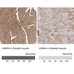 Laminin alpha-4 Polyclonal Antibody:Antibodies, Polyclonal