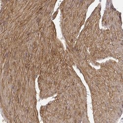 Laminin alpha-4 Polyclonal Antibody:Antibodies, Polyclonal